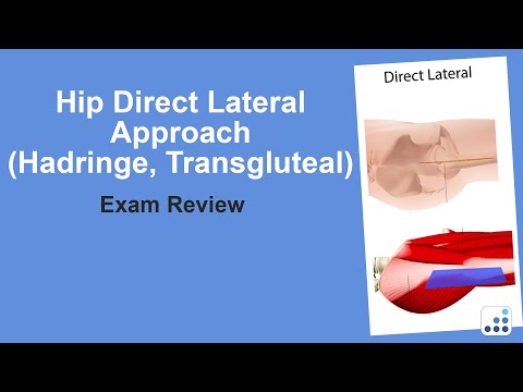 Hip Direct Lateral Approach (Hadringe or Transgluteal) Exam Review  - Doug Padgett, MD