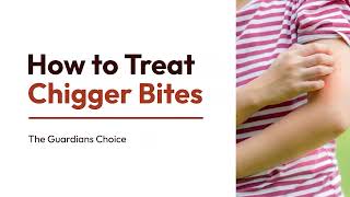 How to Identify & Treat Chigger Bites | 3 Ways to Treat Chigger Bites | The Guardians Choice