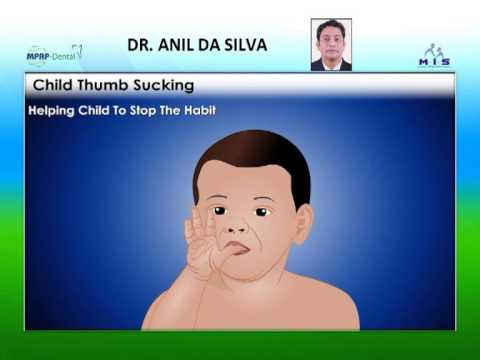 Thumb sucking habit