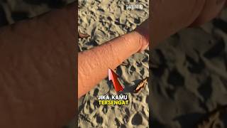 Download lagu If You Get Stung by a Jellyfish, Don't Panic #facts #jellyfish #scary #shorts mp3 Download lagu If You Get Stung by a Jellyfish, Don't Panic #facts #jellyfish #scary #shorts mp3