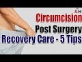 Circumcision Care After Circumcision 5 Post Circumcision Surgery Recovery Tips