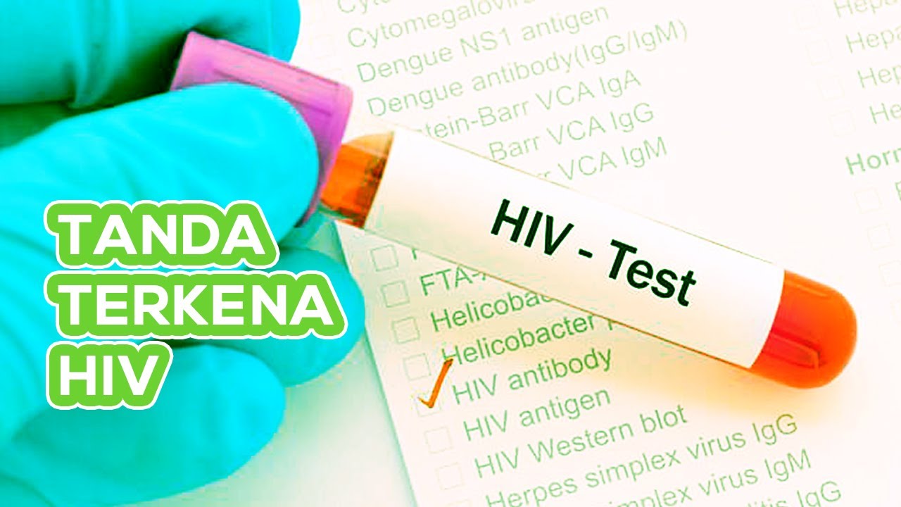 Waspada ! Ini Tanda-Tanda Kamu Terkena HIV !