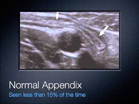 3 Gallbladder and Intestinal Ultrasound
