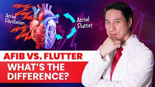 AFib vs Atrial Flutter: The Crucial Difference (and Why Flutter Is Often Curable)