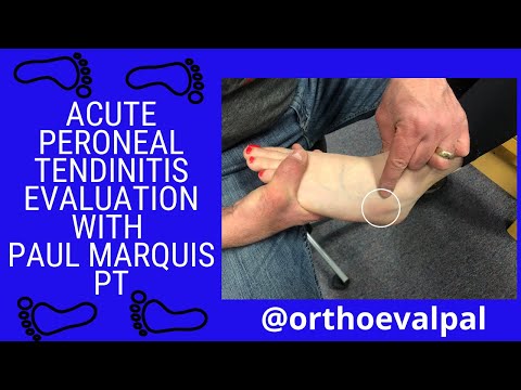 Bewertung einer akuten Peronealsehnenentzündung mit @OrthoEvalPal
