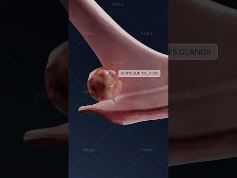 What is BARTHOLINITIS and how does it affect the vaginal area? Explore gynecology in 3D with VOKA