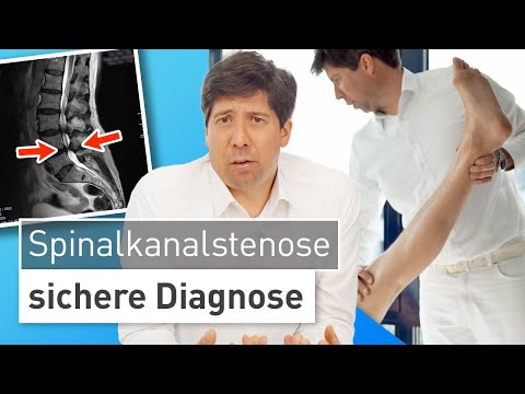 Spinal stenosis - correctly identify a common cause of leg pain! ⚠️