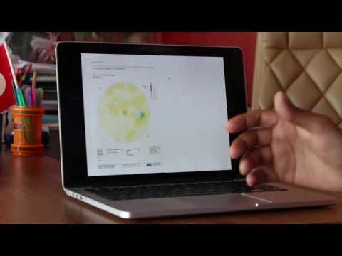 Retinitis Pigmentosa Treatment - Patient from Egypt- FIRATLI CLINIC - part 2