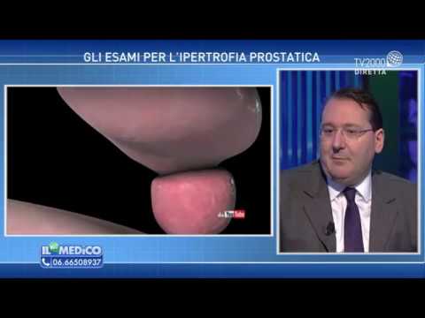 Prostatilen prezzo zinco in Kazan Massaggio prostatico cechi