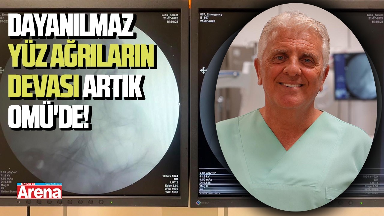 Dayanılmaz yüz ağrıların devası artık OMÜ'de!