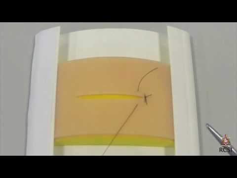 Simple interrupted suturing