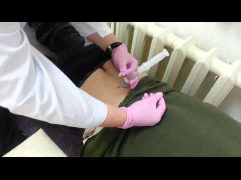 После артроскопии коленного сустава когда можно на работу Больница в дубовке лечение позвоночника воронеж