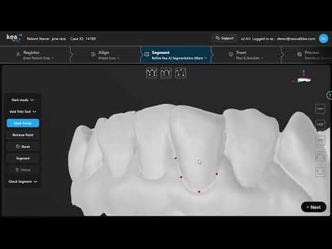 Refine Kea AI Segmentation (Mandible)