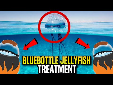 Bluebottle Jellyfish Stings: What You Need to Know & How to Treat Them