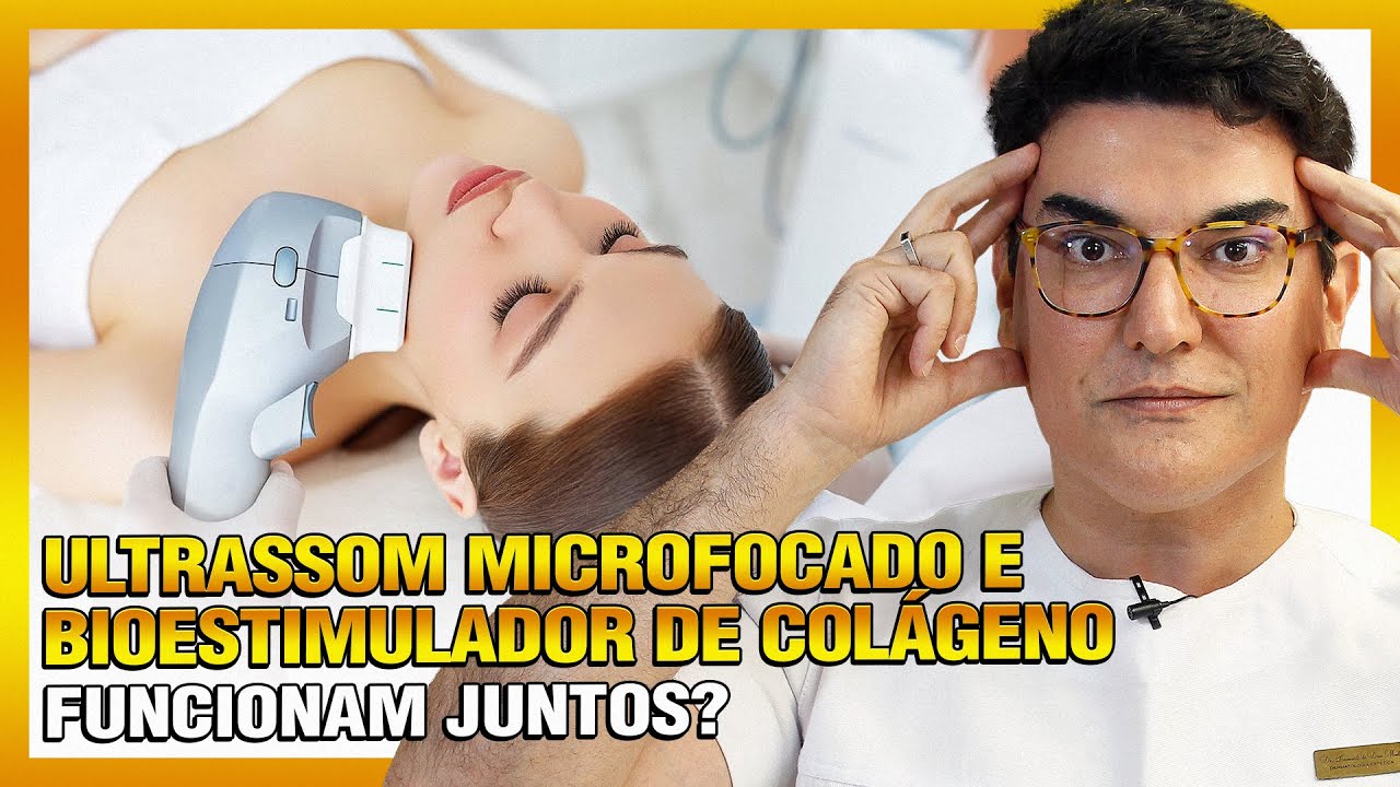 Ultrassom Microfocado e Bioestimulador de Colágeno funcionam juntos?