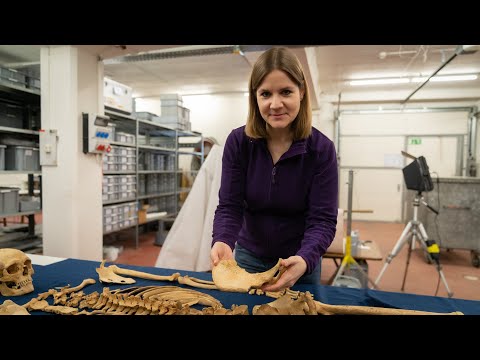 Skelettfund in Nuglar-St. Pantaleon - anthropologische Untersuchung