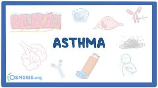 Asthma