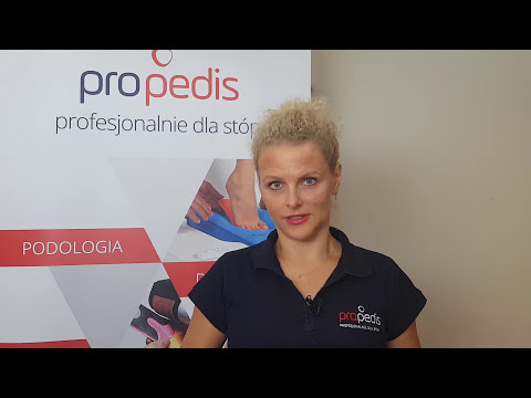 Jak rozpoznać koślawego dziecięcą Zatrzymanie choroby wpada stóp