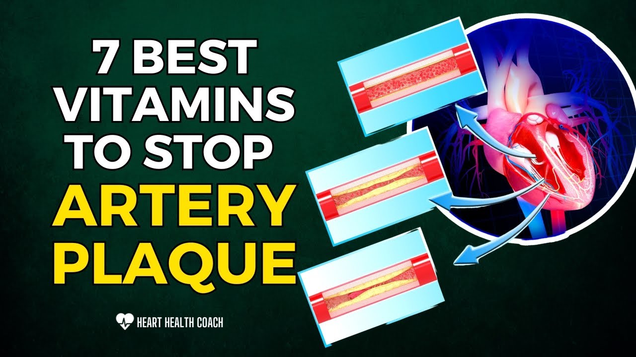 7 Best Vitamins To Stop Artery Plaque