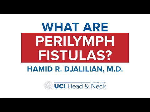 What are Perilymph Fistulas? by Dr. Hamid Djalilian - UCI Head & Neck