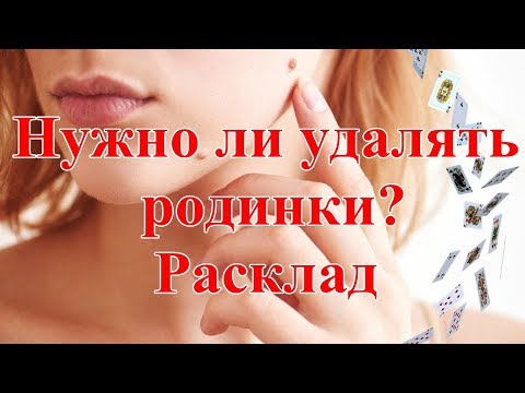 Нужно ли удалять родинки? Расклад.