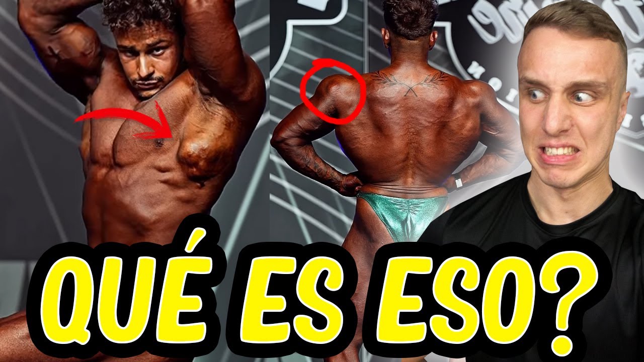 Lo peor y lo mejor del fitness *parte 9*