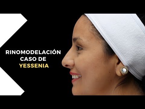 Caso de YESSENIA