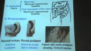 Dr Azza     Helminths   Nematodes 2    trichuris trichiura   enterobius vermicularis    YouTube
