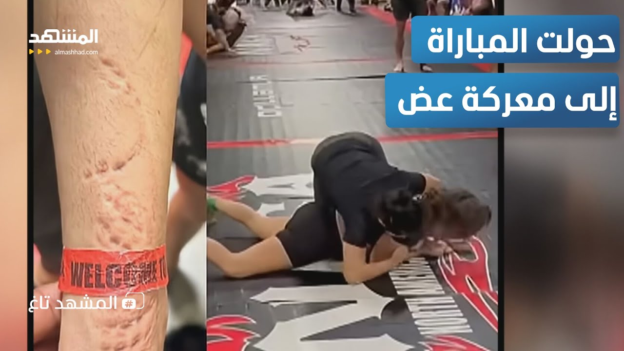 قبل أن تنهض عنها تركت بصمات أسنانها على كامل ذراعها.. مشهد صادم يهز بطولة جيجي