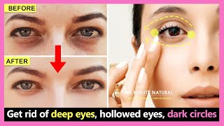 How to get rid of deep eyes, hollowed eyes, dark circles and wrinkles under the eyes | Eye exercises