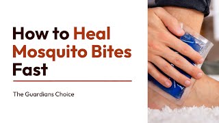 3 Easy Ways to Heal Mosquito Bites Fast | How to Heal Mosquito Bites Fast | The Guardians Choice