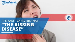 Mononukleosis, Penyakit Infeksi yang Dikenal dengan Sebutan “The Kissing Disease”
