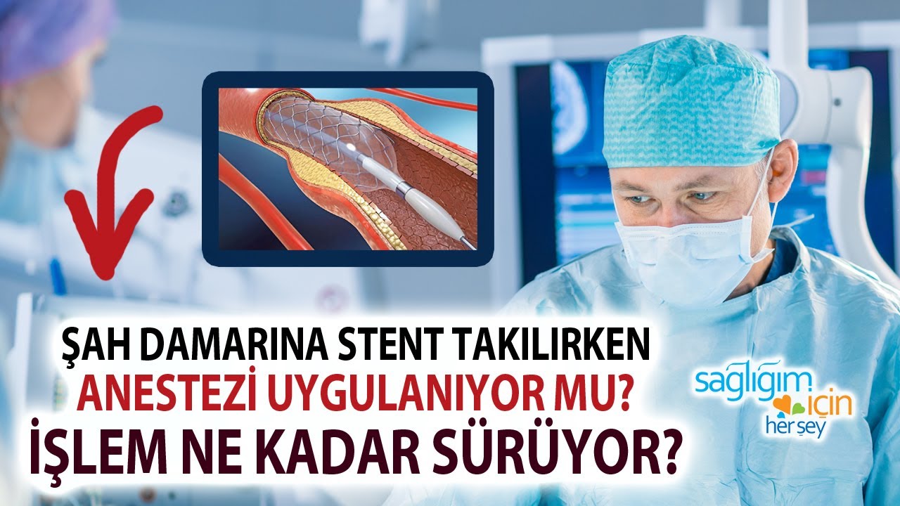 Şah Damarına Stent Takılması Sonrası