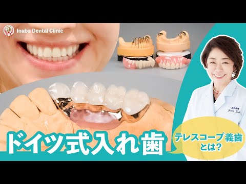 ドイツ式入れ歯 テレスコープ義歯とは？