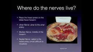 Nerve Blocks for the Hand
