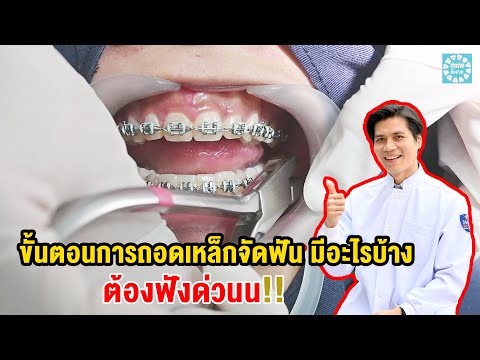 ขั้นตอน