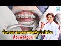 ขั้นตอน