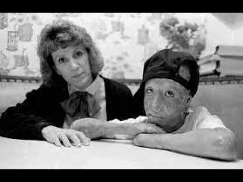 Burning of Dave Rothenberg