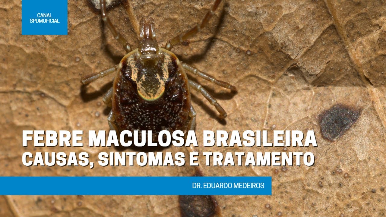Febre Maculosa Brasileira - causas, sintomas e tratamento