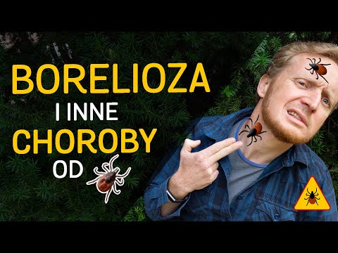 Borelioza i inne choroby przenoszone przez kleszcze - film z serii "o Kleszczach" - odc.02