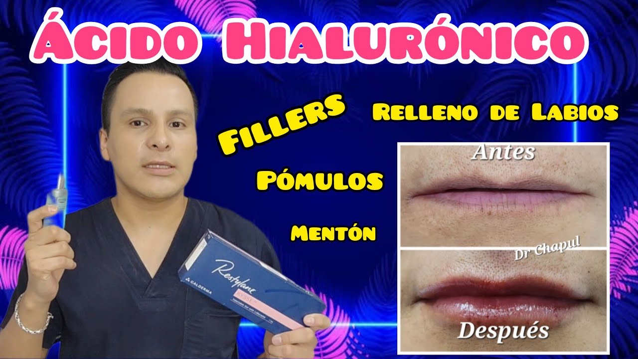 José Luis Muñoz Chapul-39