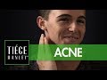 Tiege Hanley ACNE Daily Moisturizing Acne Cream Tiege Com