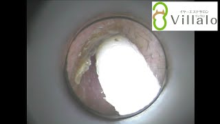 耳掃除動画vol.33「耳掃除はしてもらう派」