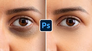 Remove Deep Dark Circles Flawlessly in Photoshop!