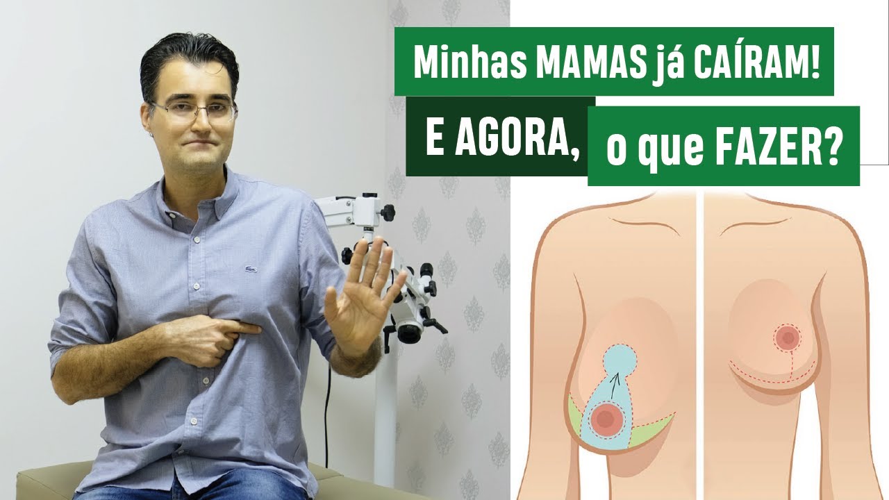 Minhas MAMAS já CAÍRAM! E AGORA, o que FAZER?