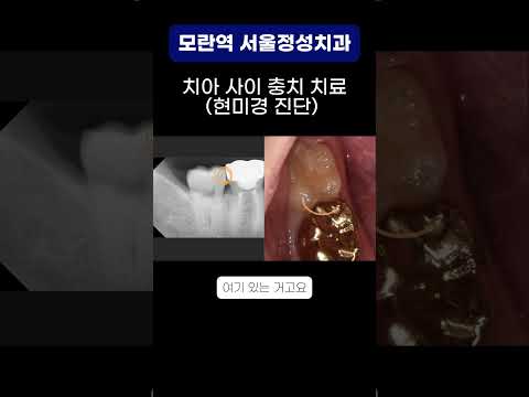땡큐성형외과 Clips