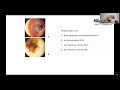 Speaker Professor Ram Dhillon Topic A Series Of Lectures A Tour Around ENT