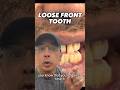 What To Do If You Have A Loose Front Tooth In Office To Hands On Dental Training Shorts