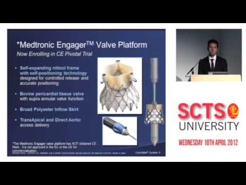 TAVI industry update