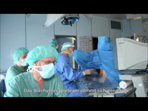 Kaufen Massage Prostata in einer Apotheke Laser-Chirurgie der BPH Chirurgie Preis
